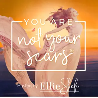 You Are Not Your Scars